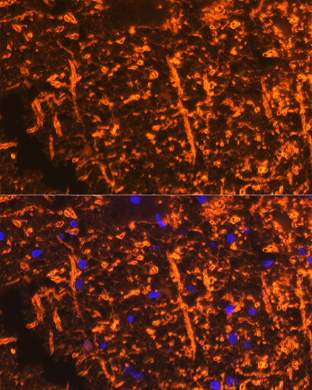 PLP1 Rabbit Polyclonal Antibody