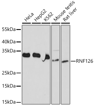 RNF126 Rabbit Polyclonal Antibody