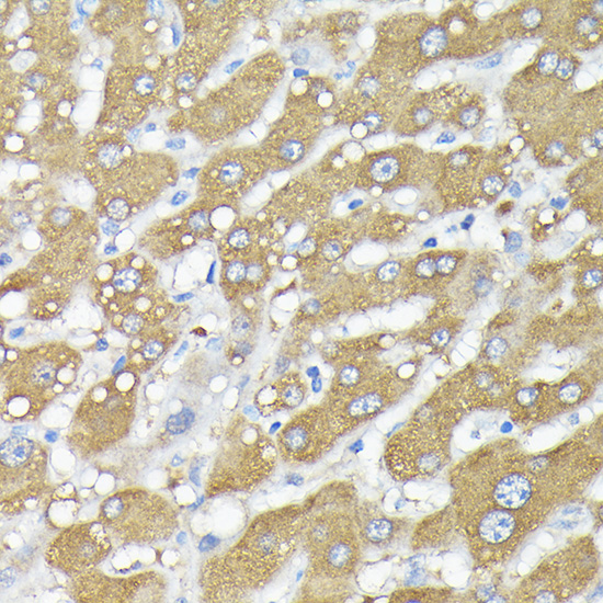 RPS6KA1/RPS6KA2/RPS6KA3 Rabbit Polyclonal Antibody