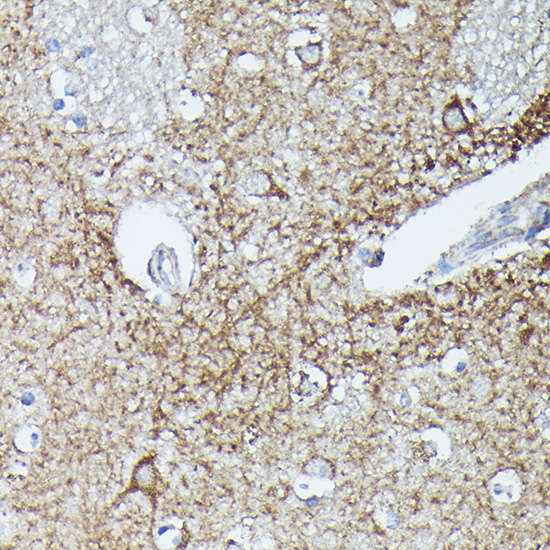 RAB11A/RAB11B Rabbit Polyclonal Antibody
