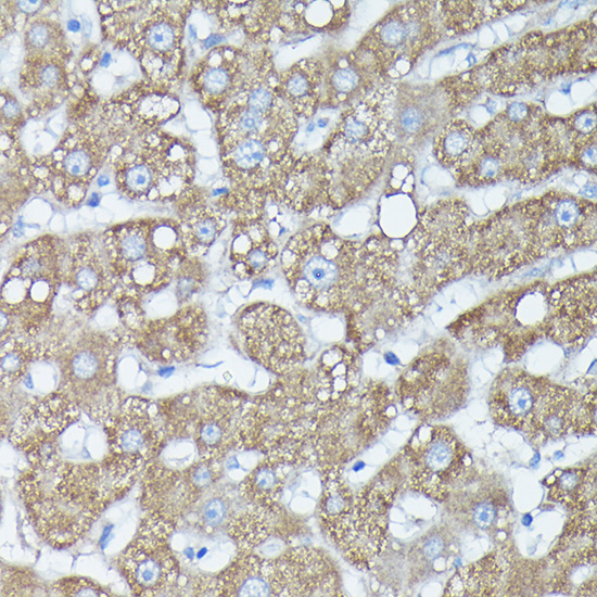 RAB11A/RAB11B Rabbit Polyclonal Antibody