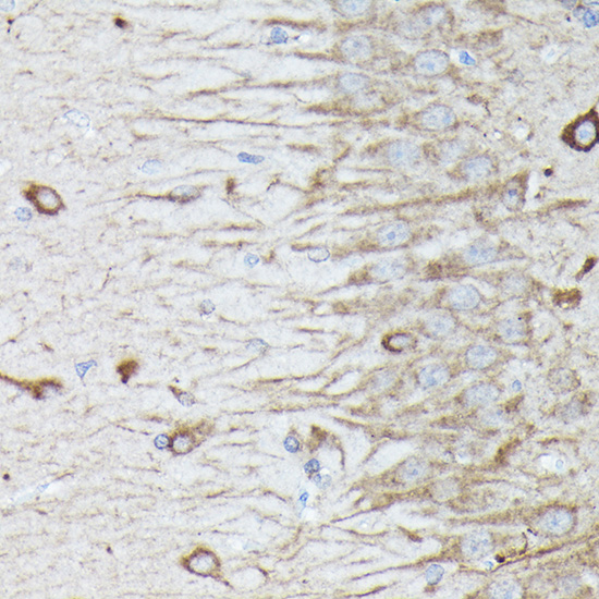 RAB11A/RAB11B Rabbit Polyclonal Antibody