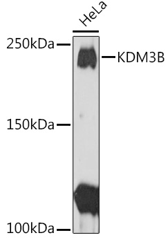 KDM3B Rabbit Polyclonal Antibody