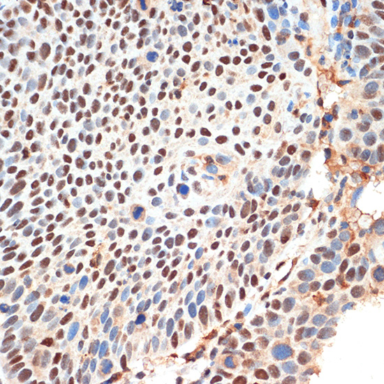 KDM3B Rabbit Polyclonal Antibody