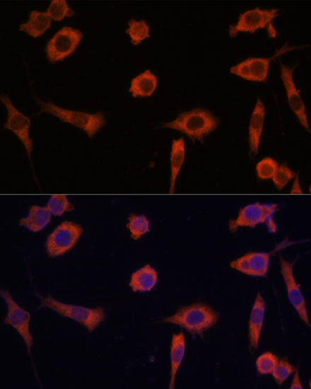 STING / TMEM173 Rabbit Polyclonal Antibody