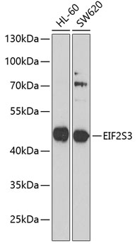 EIF2S3 Rabbit Polyclonal Antibody