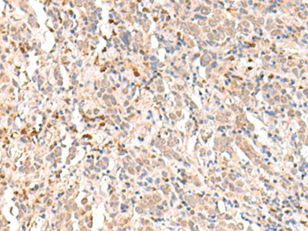 RBM19 Antibody