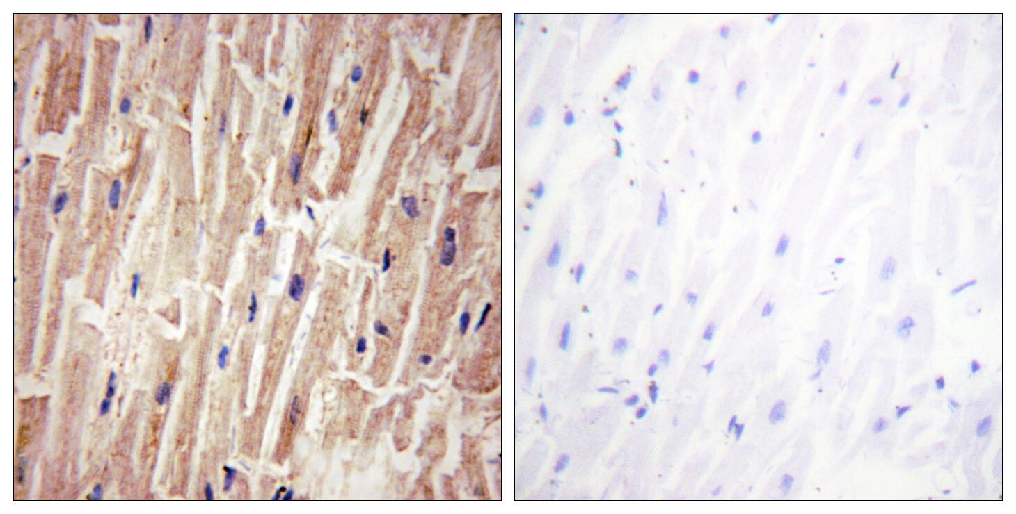 YAP (Phospho-Ser127) Antibody