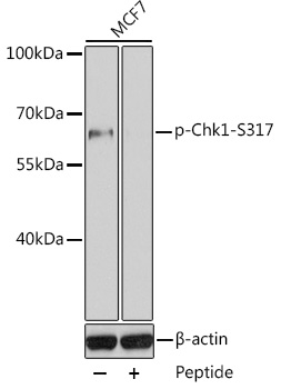 CHEK1(Phospho-Ser317) antibody