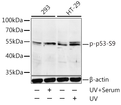 TP53(Phospho-Ser9) antibody