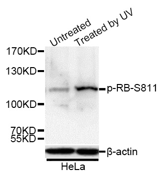 RB(Phospho-Ser811) antibody