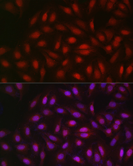 PGC1 alpha Polyclonal Antibody