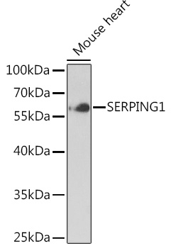 C1 Inactivator Polyclonal Antibody
