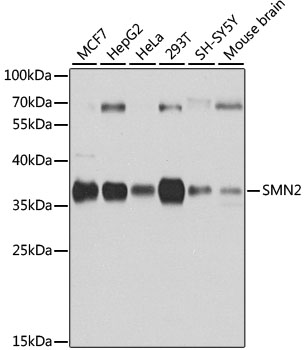 SMN2 Polyclonal Antibody