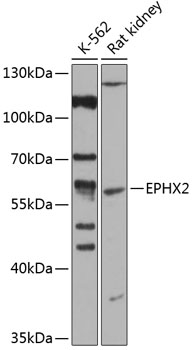 EPHX2 Polyclonal Antibody