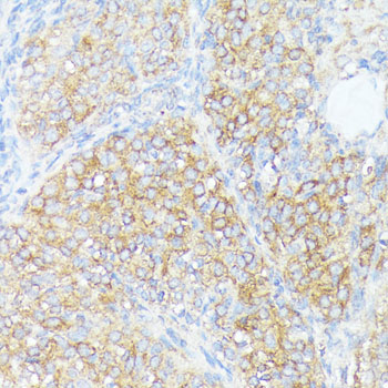 SLC7A2 Polyclonal Antibody