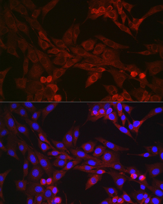 GSDMD (Full length+C terminal) Polyclonal Antibody