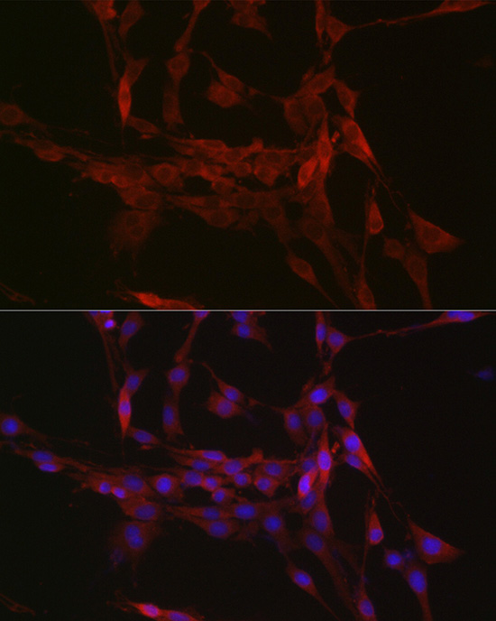 GSDMD (Full length+C terminal) Polyclonal Antibody