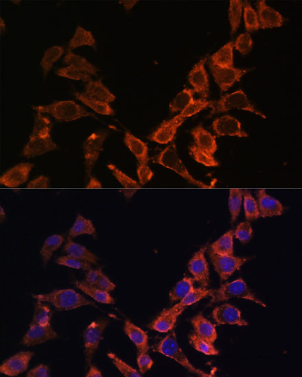 MT-ND4 Polyclonal Antibody