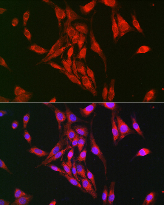 Gasdermin-D Polyclonal Antibody