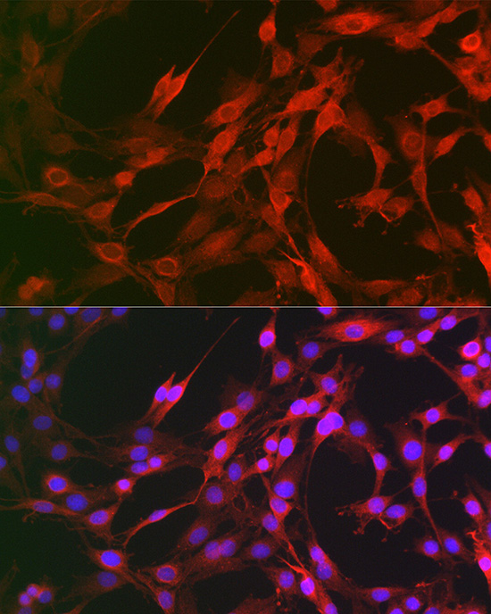 Gasdermin-D Polyclonal Antibody