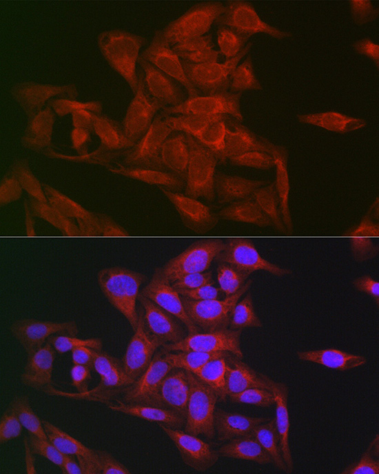 Gasdermin-D Polyclonal Antibody