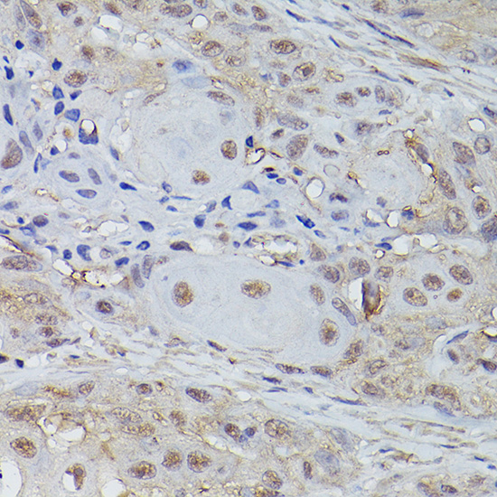 TET3 Polyclonal Antibody