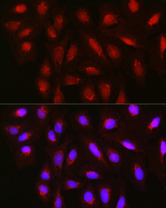 TET3 Polyclonal Antibody