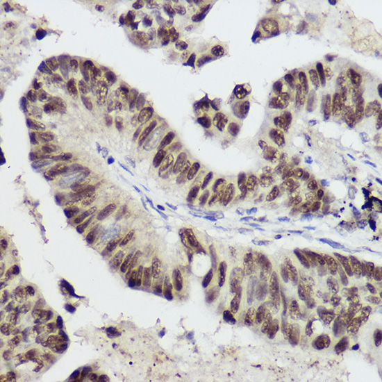 STAT1 Antibody