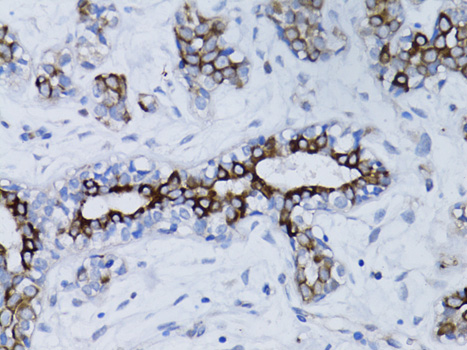 BRCA1 Antibody