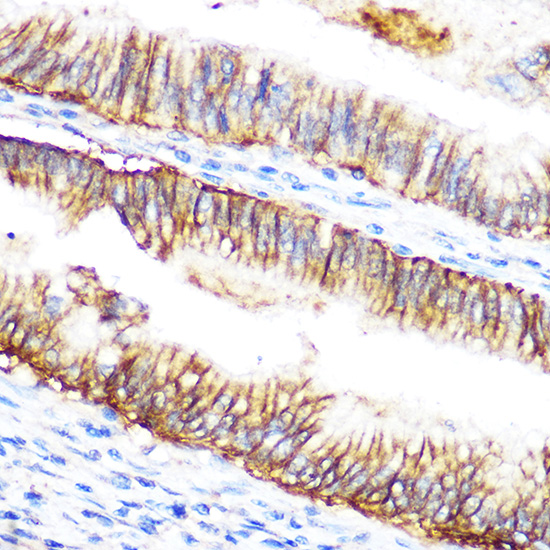 RAF1 Antibody