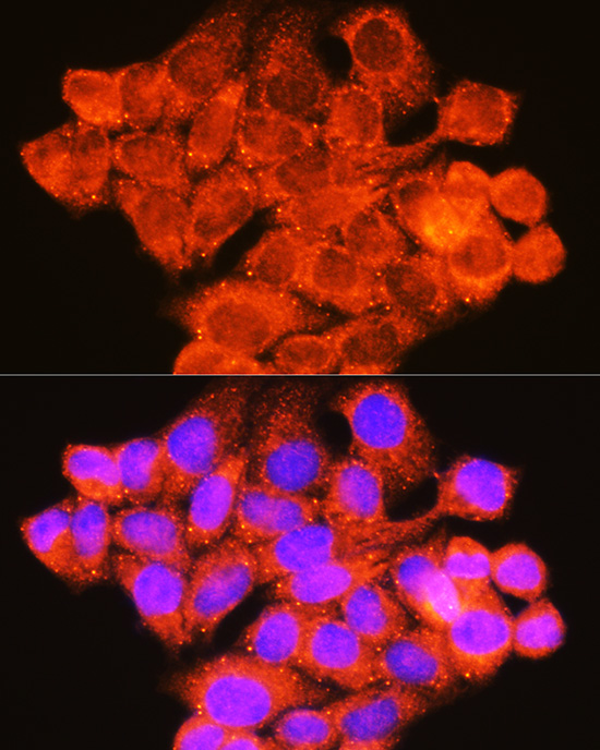 RAF1 Antibody