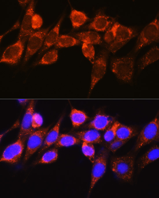 RAF1 Antibody