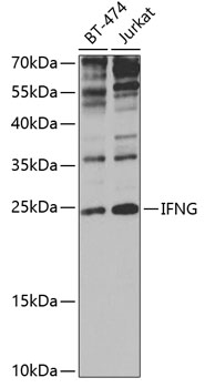 IFNG Antibody