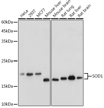 SOD1 Antibody