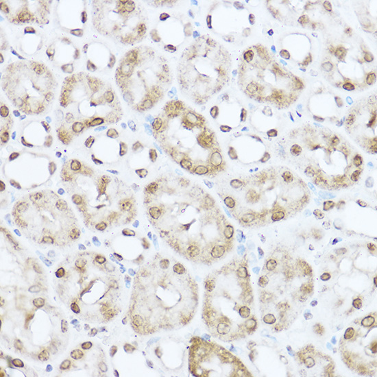 SOD1 Antibody