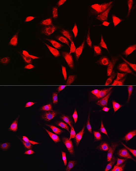 SOD1 Antibody