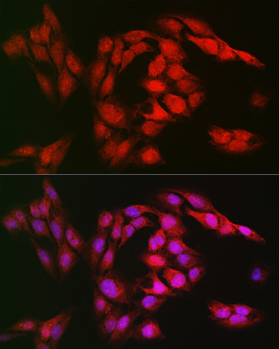 SOD1 Antibody