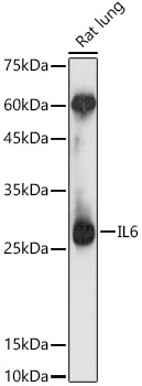 IL6 Antibody