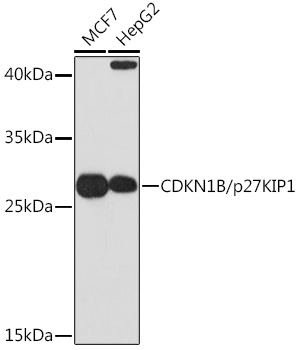 CDKN1B Antibody