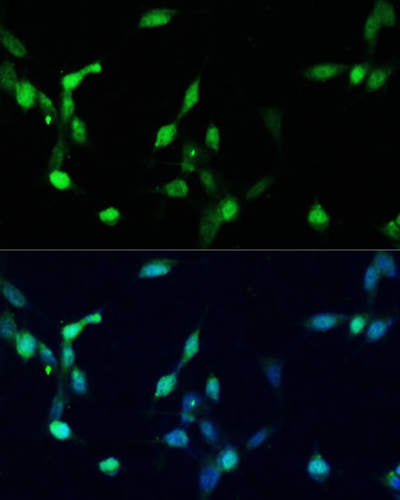 CDKN1B Antibody