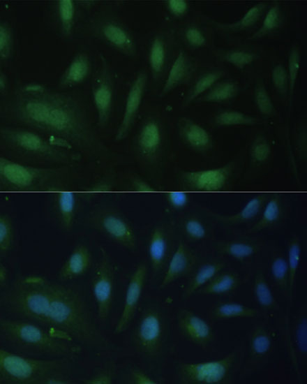 CDKN1B Antibody