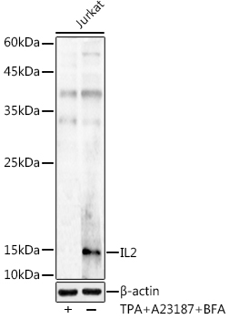 IL2 Antibody