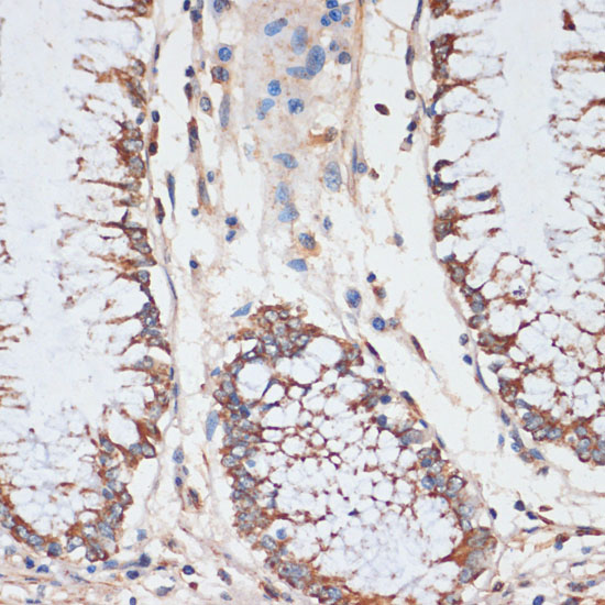 CDK4 Antibody