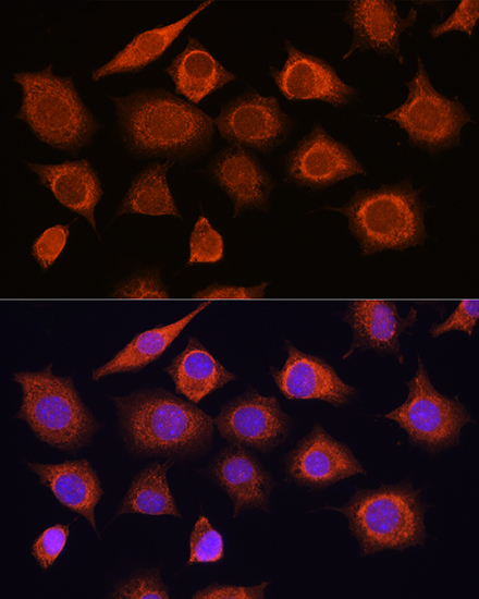 DDX58 Antibody