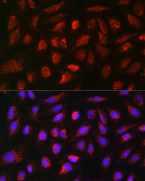 BMP7 Antibody