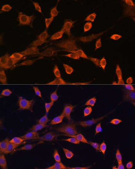 PRKAR1A Antibody