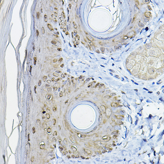 SFN Antibody