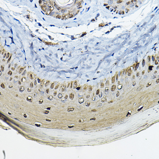 SFN Antibody