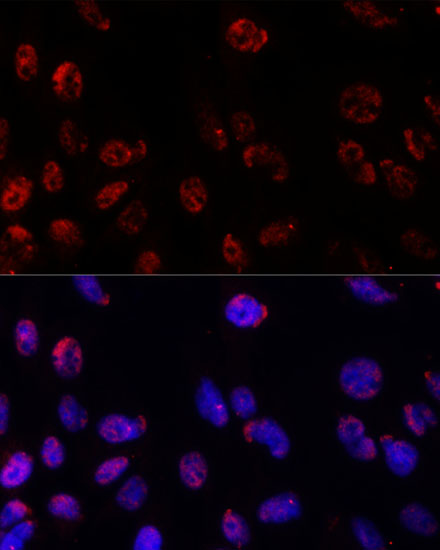 PSMB1 Antibody